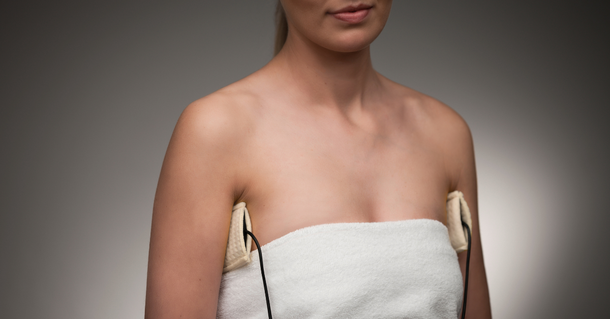 A woman with iontophoresis electrode pads positioned under each arm for an axillary hyperhidrosis (excessive underarm sweating) treatment session.